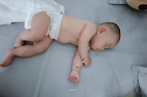 哈尔滨宝宝头上长痱子